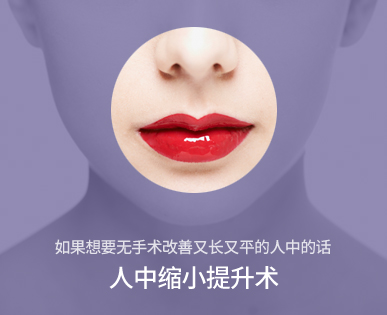 인중 축소 리프팅