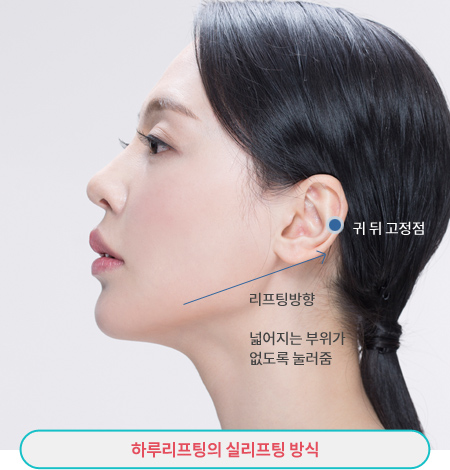 하루리프팅의 실리프팅 방식