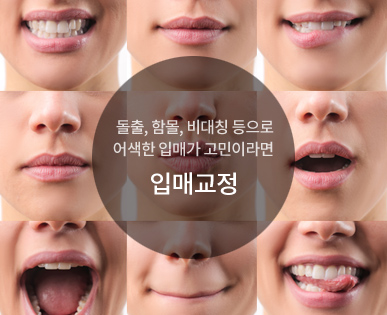 입매교정