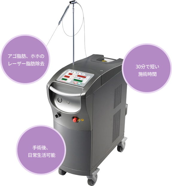 아큐스컬프 레이저